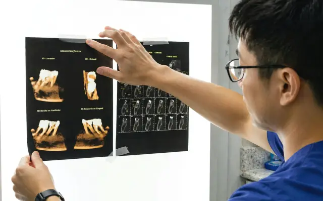 Dentist examining dental X-ray scans on a light board